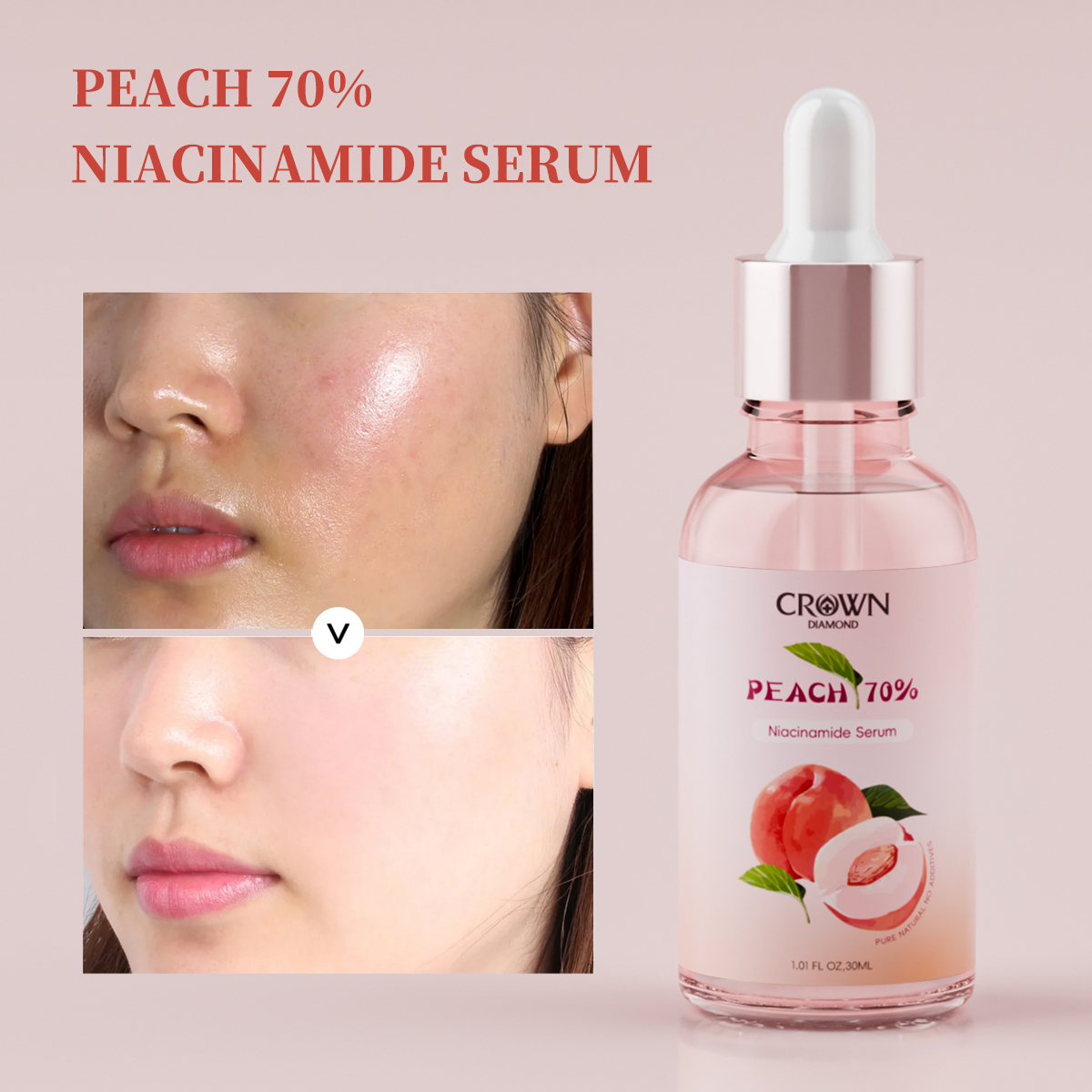 Private label Korean glass skin peach niacinamide serum product reference