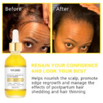 Private Label Biotin Hair Growth Serum