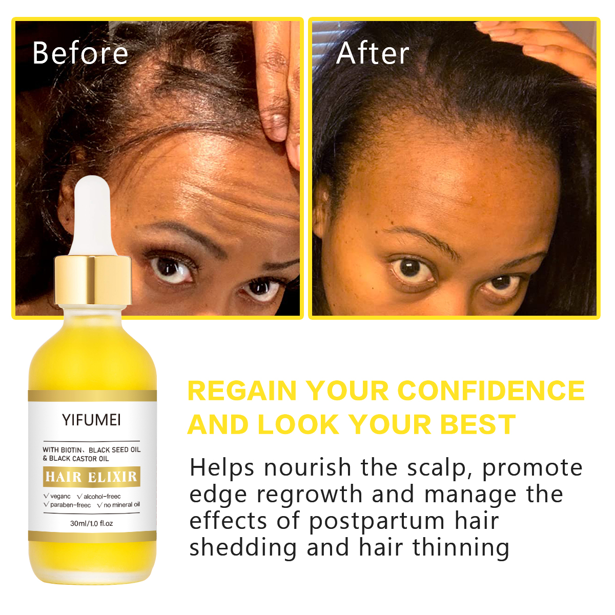 Private Label Biotin Hair Growth Serum