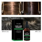 Private Label Ginger Rosemary Hair Regrowth Oil