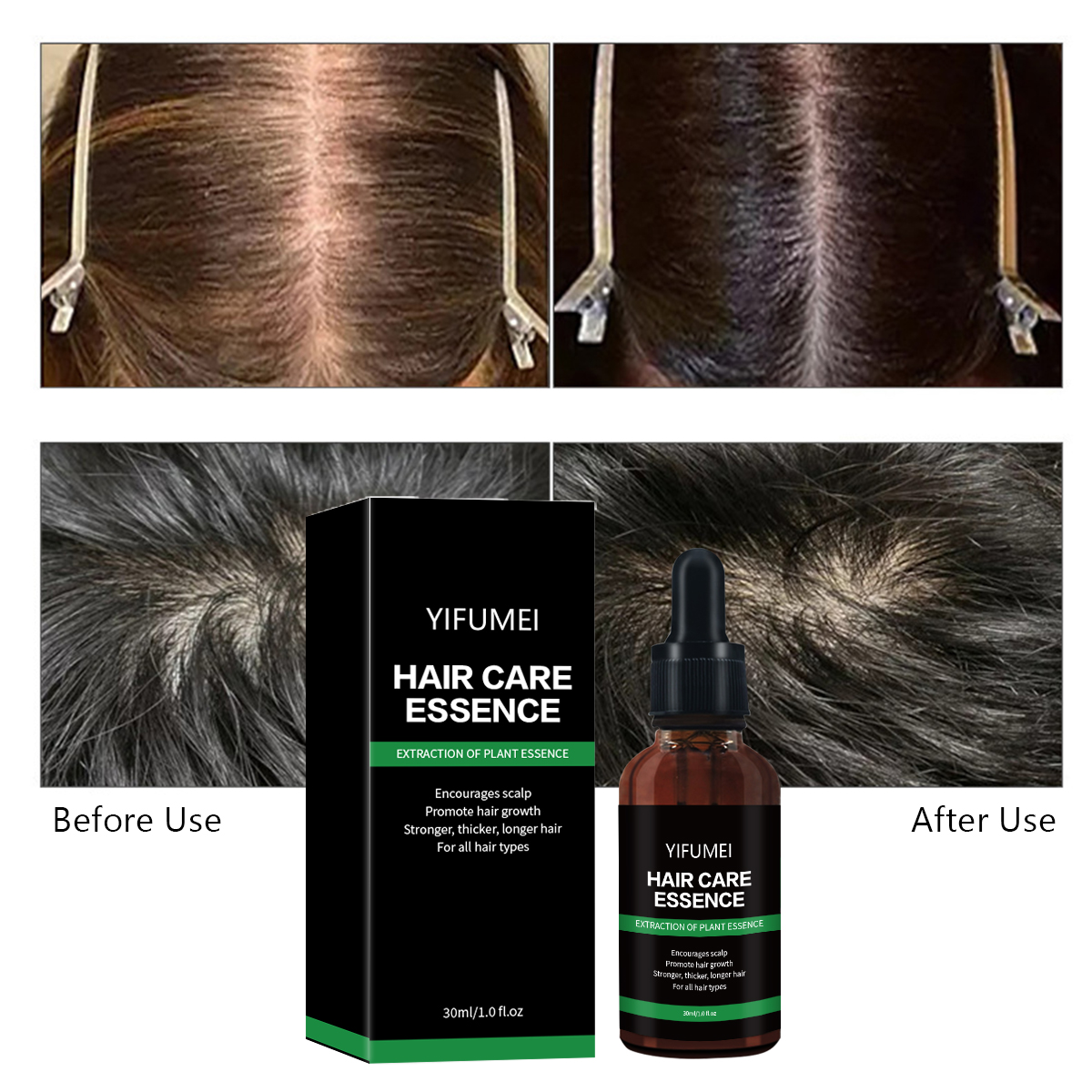 Private Label Ginger Rosemary Hair Regrowth Oil