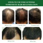 Private Label Ginger Rosemary Hair Regrowth Oil