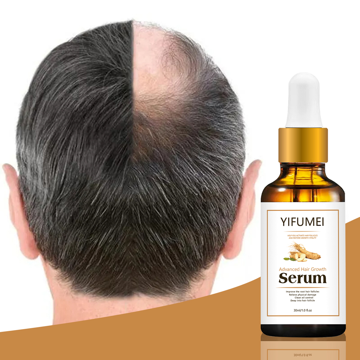 Private Label Ginseng Angelica Ginger Hair Regrowth Serum