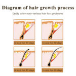 Private Label Ginseng Angelica Ginger Hair Regrowth Serum