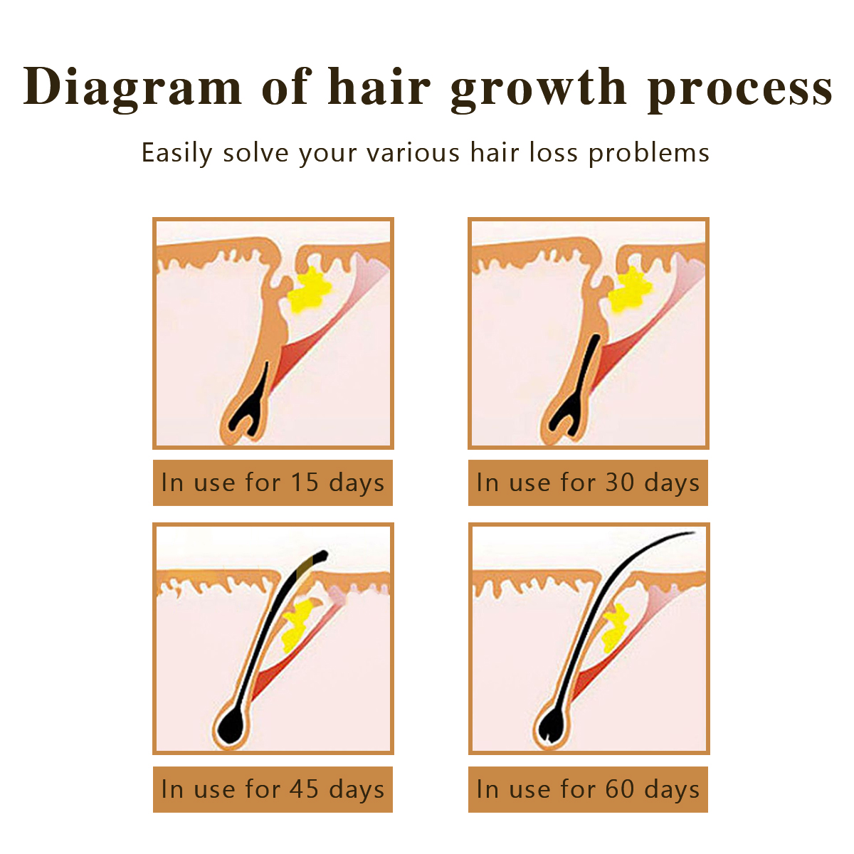Private Label Ginseng Angelica Ginger Hair Regrowth Serum