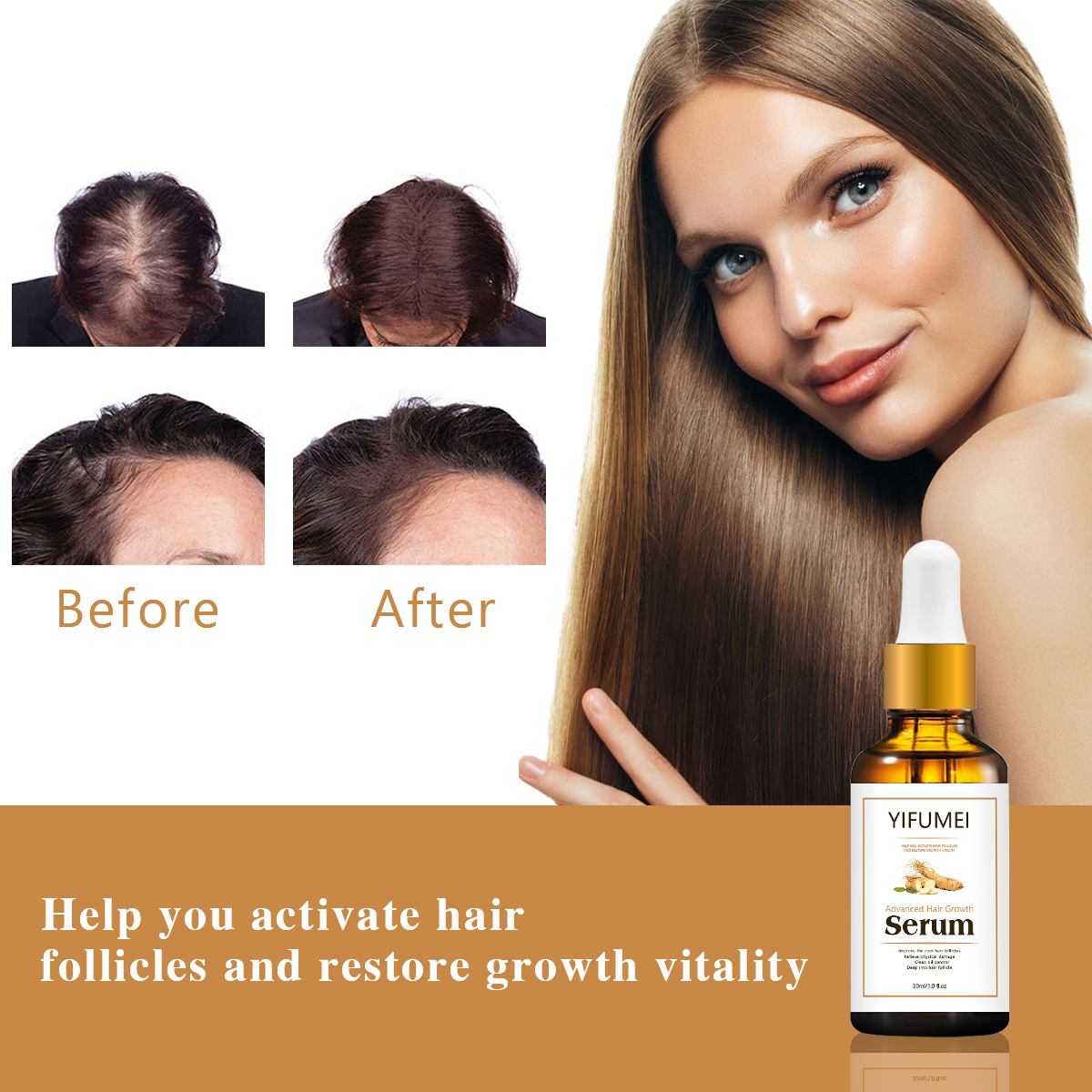 Private Label Ginseng Angelica Ginger Hair Regrowth Serum