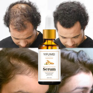 Ginseng Angelica Ginger Hair Regrowth Serum main product image and packaging