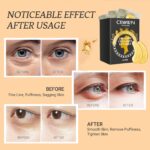 Private Label 24K Gold Collagen Eye Patches