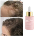 Private Label Rosemary Hair Growth Serum