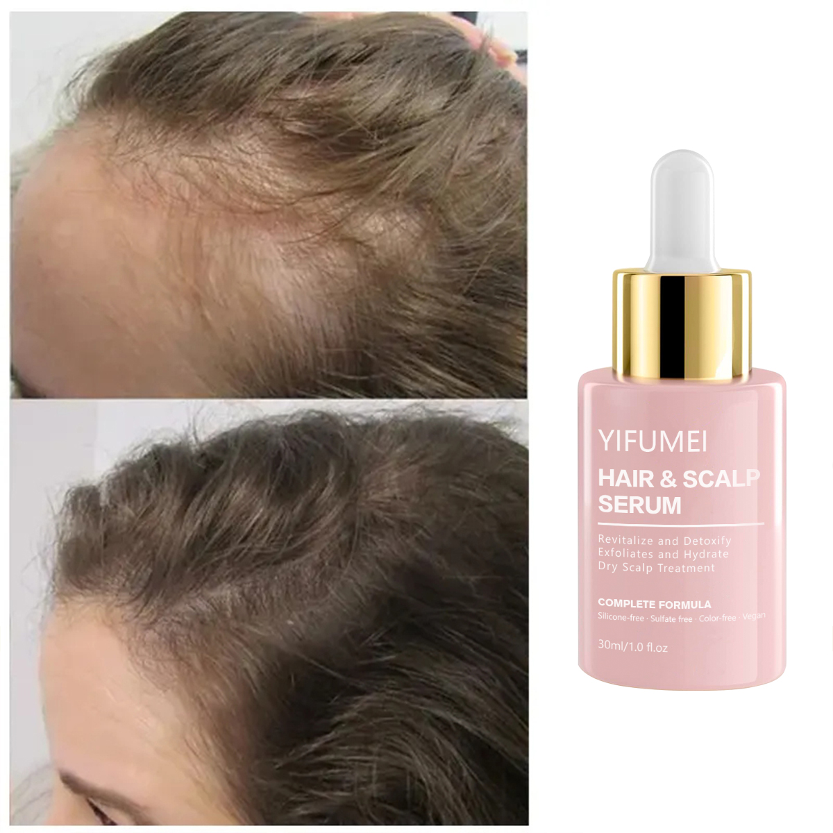 Private Label Rosemary Hair Growth Serum