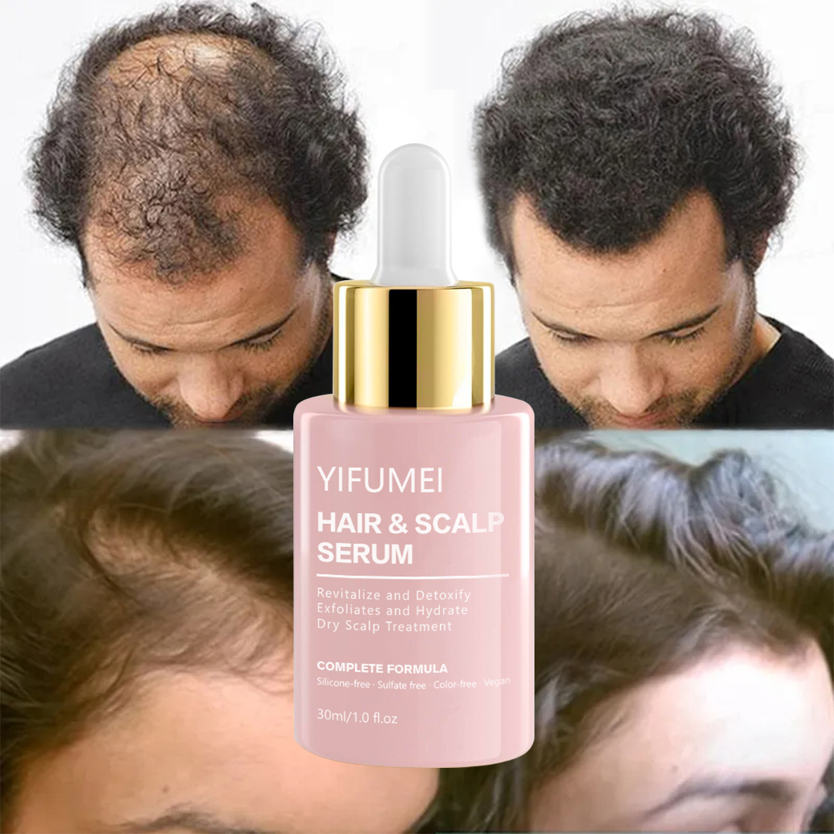 Private Label Rosemary Hair Growth Serum