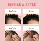 Private Label Rosemary Hair Growth Serum