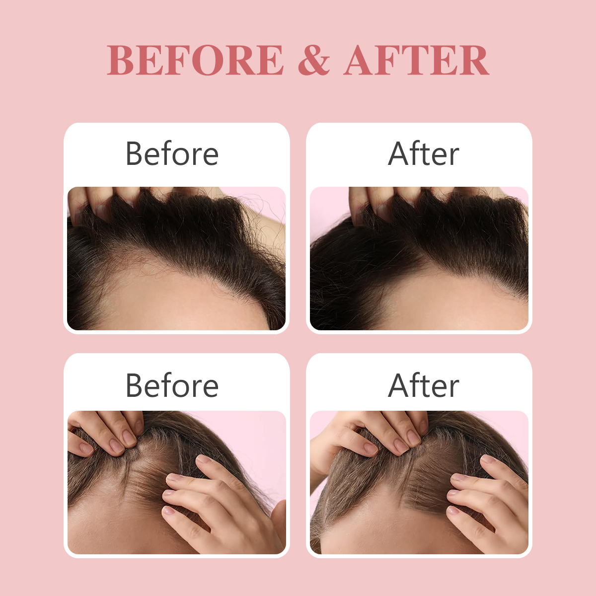 Private Label Rosemary Hair Growth Serum